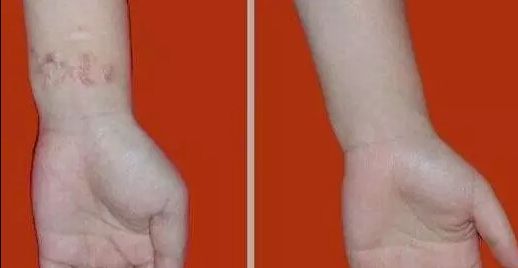 杭州哪家醫(yī)院看喉嚨好？排名最好的專業(yè)醫(yī)院推薦