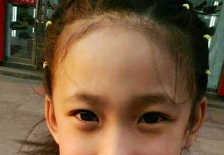 蘇州激光祛疤哪家醫(yī)院好？選擇激光祛疤專家，恢復美肌無憂！