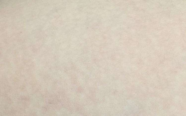 大連哪位醫(yī)生在顴骨整形方面?zhèn)涫懿毮?？關(guān)注的5位專家包括關(guān)世超、張東、蔡軍。