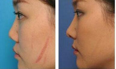 2023煙臺秒雕祛眼睛細(xì)紋專家前十名排名榜(劉興國、劉穎慧、曹光福評價值得看)