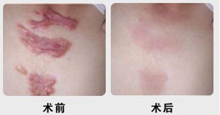 昆明有沒有哪家專業(yè)祛痘醫(yī)院值得推薦？