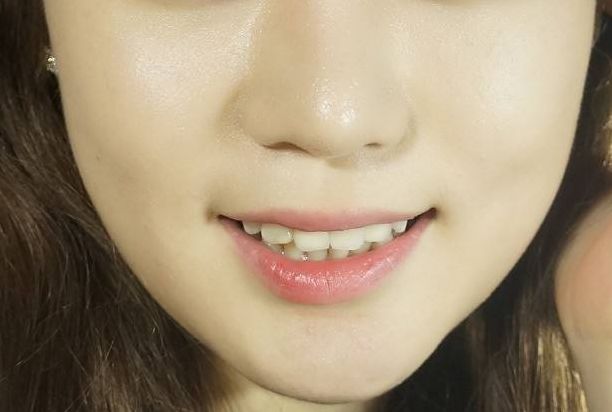 廣州集美醫(yī)療美容怎么樣？廣州集美醫(yī)療美容簡(jiǎn)介|醫(yī)生團(tuán)隊(duì)|口碑評(píng)價(jià)！