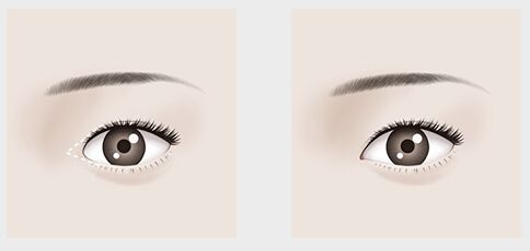 沈陽假體隆胸手術(shù)哪家好？專家推薦排行榜揭曉