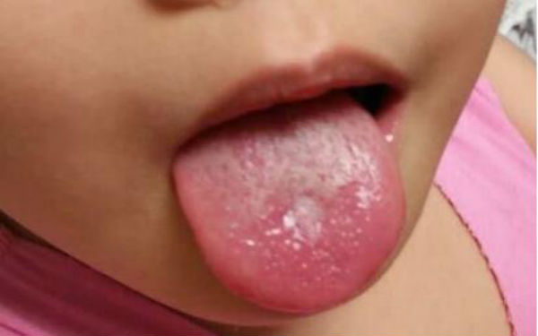 2023貴陽(yáng)手術(shù)切除額頭紋專家口碑榜前10名(徐春佳、朱鴻雁、余升原口碑優(yōu)異，速覽~)