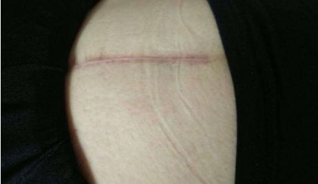 杭州市哪家醫(yī)院的玻尿酸注射技術(shù)更好？附醫(yī)生資料及整形科點(diǎn)評