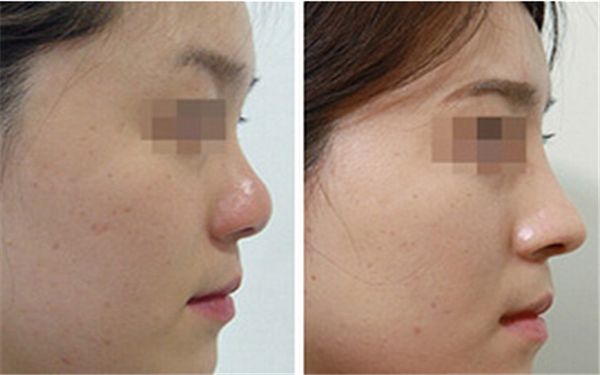 珠海市醫(yī)療美容醫(yī)院哪家好？解析當(dāng)今最受歡迎的珠海醫(yī)療美容機構(gòu)