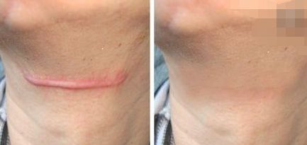 貴州哪個(gè)醫(yī)院做眼袋手術(shù)好