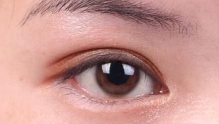 蘇州雙眼皮修復(fù)醫(yī)院排名及口碑，哪家醫(yī)院修復(fù)效果最好？