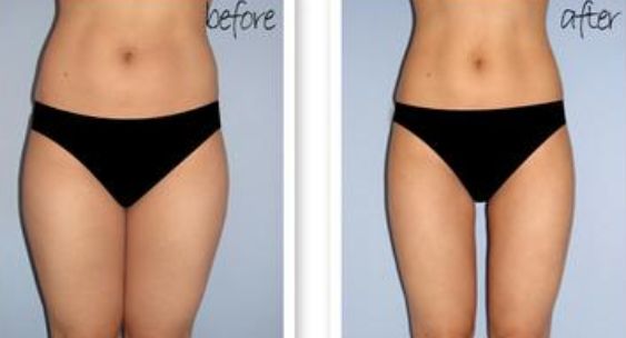 2023保定瘦臉針去咬肌排行前十位醫(yī)生(梁騫、魏繼鵬、吳瓊這些醫(yī)生體驗感超好)