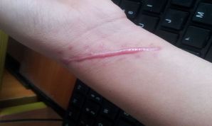 上海鼻子整形哪家醫(yī)生好？整形手術(shù)中哪位醫(yī)生在上海受歡迎？