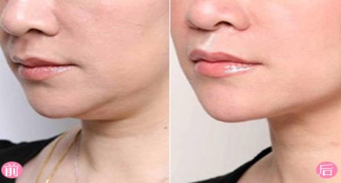 上海去除胎記醫(yī)院排名及口碑評(píng)測(cè)，哪家醫(yī)院最受用戶(hù)好評(píng)？