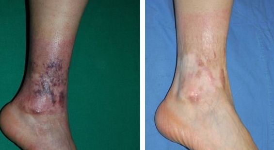 上海手術(shù)點(diǎn)痣醫(yī)院哪家好？揭秘上海最受歡迎的點(diǎn)痣醫(yī)院