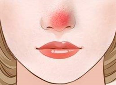 廣州最新開設(shè)的軍事美容整形醫(yī)院，王世虎是權(quán)威整形專家，手術(shù)價便宜