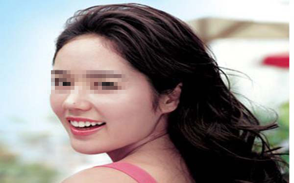 2023佛山小切口去面部皺紋專家上榜前十位(李青輝、薛國初、李正曄口碑實(shí)力都不錯(cuò)~)