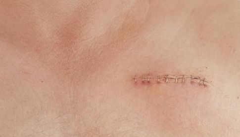 南昌市整形醫(yī)院哪家好？完全解析南昌市整形醫(yī)院的專業(yè)技術(shù)和服務(wù)