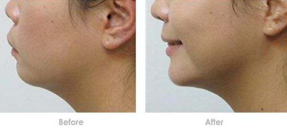 成都哪家醫(yī)美醫(yī)院做皮秒好？了解成都皮秒治療哪家醫(yī)院口碑好