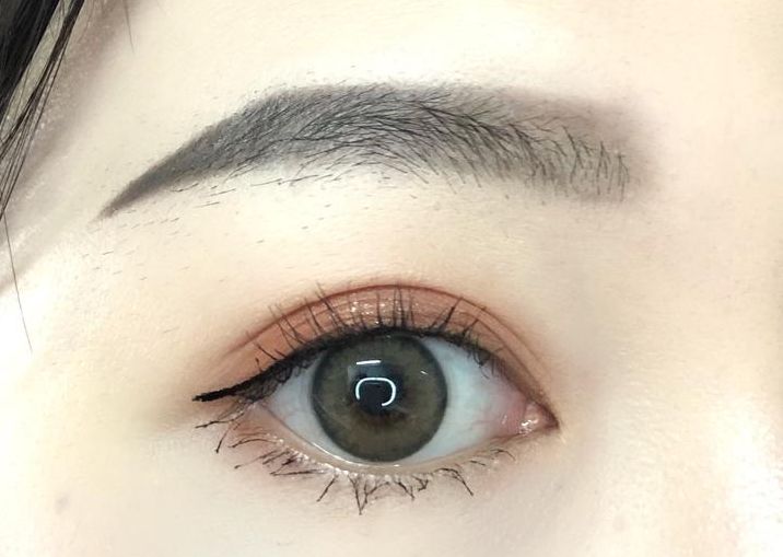 承德哪家整形醫(yī)院做雙眼皮效果好，選擇哪家醫(yī)院做雙眼皮效果最好