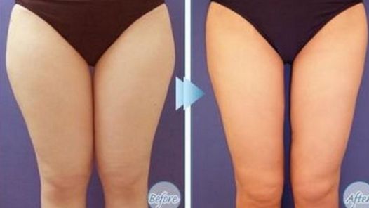 浙江有哪些值得推薦的皮膚整容醫(yī)院？