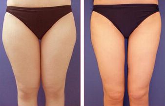 廣州看痘印哪家醫(yī)院好？細數(shù)廣州治療痘印最佳醫(yī)院！