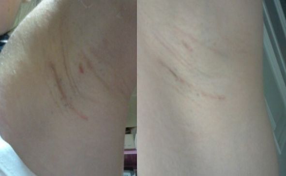 恩施地區(qū)有哪些信譽(yù)好的美容整形醫(yī)院？