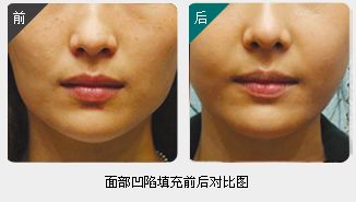 錦州整形美容醫(yī)院哪家靠譜？醫(yī)療技術(shù)如何？