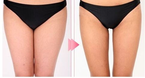 昆明哪家醫(yī)院做拉皮手術(shù)好？體驗(yàn)分享+專家推薦，盡在本文！