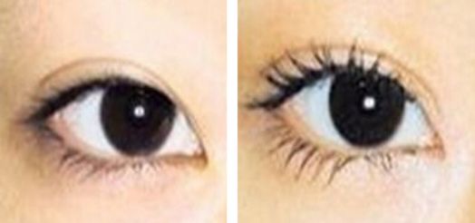 天津治療疤痕的頂級(jí)醫(yī)院推薦，哪家醫(yī)院治療疤痕效果最好