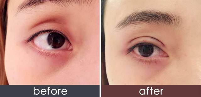 2023馬鞍山鐳射祛斑醫(yī)生前十位排行榜(石京頤、石京頤、周曉晶排名不分先后，一睹為快~)