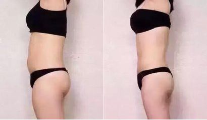 太原哪家醫(yī)院祛痘效果好？專家推薦的太原祛痘醫(yī)院排行榜