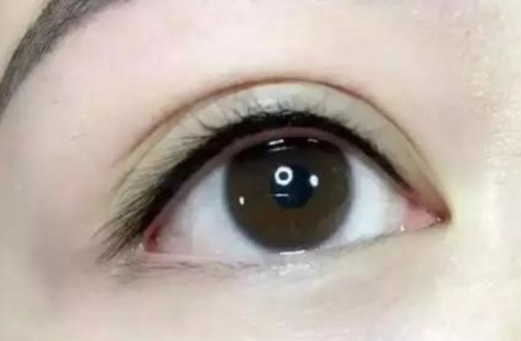 北京雅靚萬旭輝，豐胸手術(shù)效果如何？