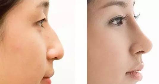 2023武漢像素激光祛痘坑正規(guī)專家上榜前10位(楊宏剛、吳俊華、楊國梁價格實惠公道)