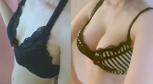 廣州哪家醫(yī)院做微針好？解讀廣州市內(nèi)頂尖微針治療機(jī)構(gòu)