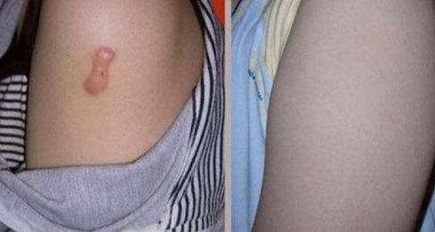 長(zhǎng)沙整形哪家美容醫(yī)院好？專(zhuān)家揭秘長(zhǎng)沙市頂級(jí)整形醫(yī)院排行榜！