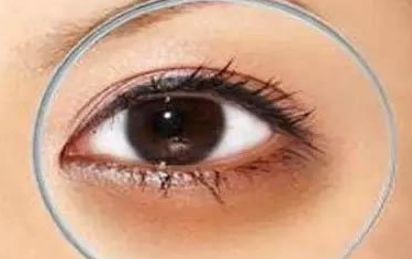 南寧雙眼皮手術哪家好？推薦南寧市口碑最佳的雙眼皮手術醫(yī)院