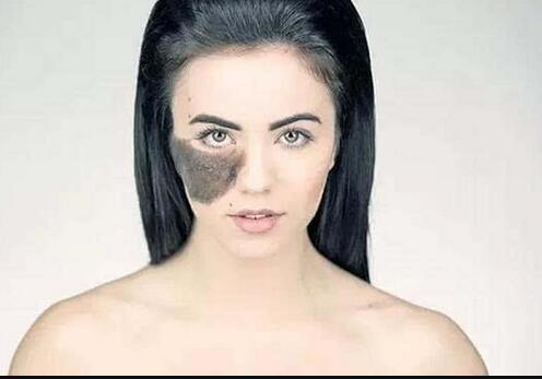 北京比較好的整容醫(yī)院楊欣的吸脂減肥技術(shù)效果如何？