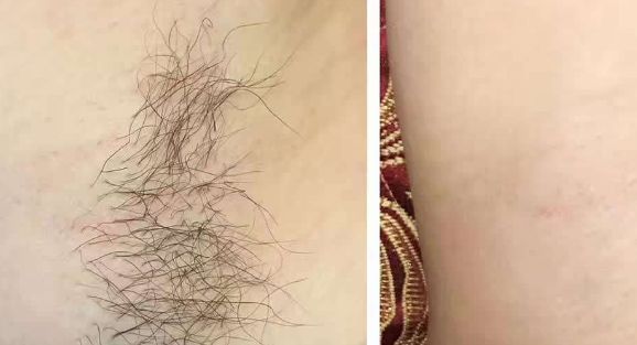 臺(tái)州箬橫中心衛(wèi)生院怎么樣？臺(tái)州箬橫中心衛(wèi)生院簡(jiǎn)介|醫(yī)生團(tuán)隊(duì)|口碑評(píng)價(jià)！