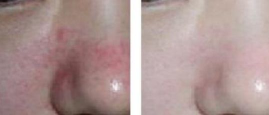 南京整鼻哪家醫(yī)院口碑好？