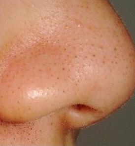 2023重慶填充動態(tài)細(xì)紋凹陷排行top10強(qiáng)的醫(yī)生(鄧穎&nbsp;、張代祿、田凱私立醫(yī)美有看頭)