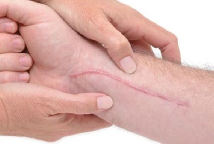 尋找大連最好的隆鼻醫(yī)院，準(zhǔn)確解答“大連哪家醫(yī)院做隆鼻手術(shù)好