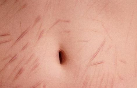 亳州哪家雙眼皮醫(yī)院口碑好，值得信賴(lài)？