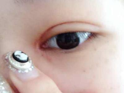 2023寧波顯微靈動重瞼術(shù)專家前10位排名榜(童迎迎、王昊、張建波口碑與實力的選擇)