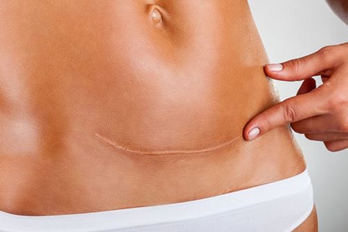 2023西安雙眼皮最佳醫(yī)院排行榜：哪家醫(yī)院的雙眼皮效果好？