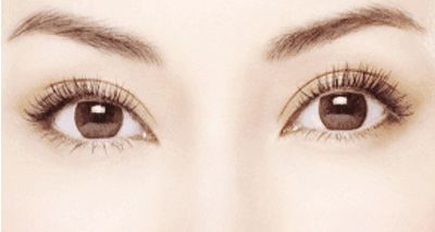 杭州整形哪家好祛眼袋？選擇杭州哪家整形醫(yī)院好祛眼袋效果持久？