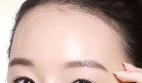 常州治療脫發(fā)哪家醫(yī)院靠譜？