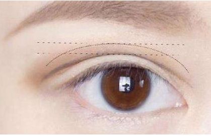 佛山哪家整容醫(yī)院的隆鼻效果出色？