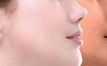 2023昆明點(diǎn)陣去老年斑正規(guī)專家口碑前十(張景波、夏國興、楊光華詳版簡介一覽)