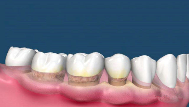 2023長沙激光溶脂瘦臀醫(yī)生推薦前10位(吳東輝、魏琳勻、唐其科都是當(dāng)?shù)貎?yōu)質(zhì)醫(yī)生)