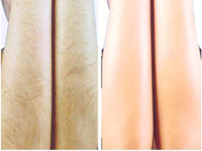 2023石家莊保妥適肉毒素注射前十強專家(任啟瑞、宋子軍、鄭鳳蘭技術(shù)、設(shè)備領(lǐng)先)