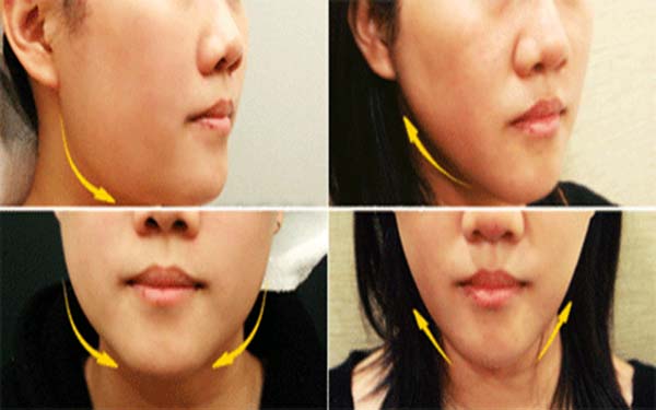 2023烏魯木齊除皺針祛下眼皮皺紋專家前十名(肖春蘭、王寶琳、劉春燕都是實(shí)力派)