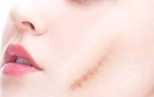 邢臺市下面部拉皮哪家好？匯總一線城市熱門醫(yī)院推薦